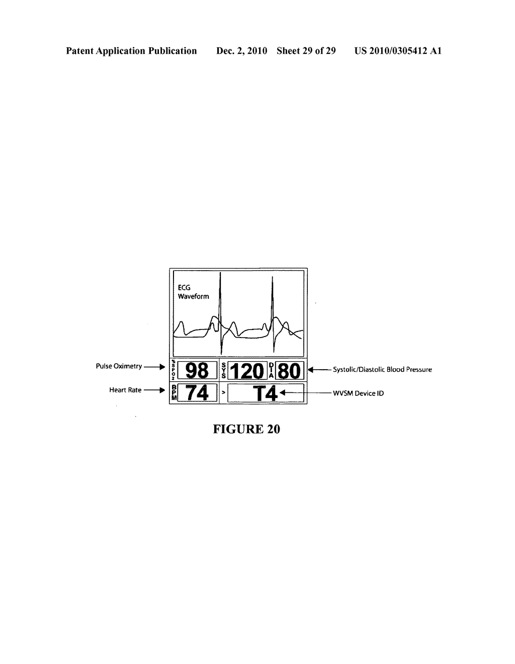 Device and system for wireless monitoring of the vital signs of patients - diagram, schematic, and image 30