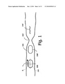 DEVICE, SYSTEM AND METHOD FOR EXAMINING A BODY LUMEN diagram and image