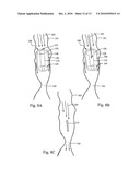 DEVICE, SYSTEM AND METHOD FOR EXAMINING A BODY LUMEN diagram and image