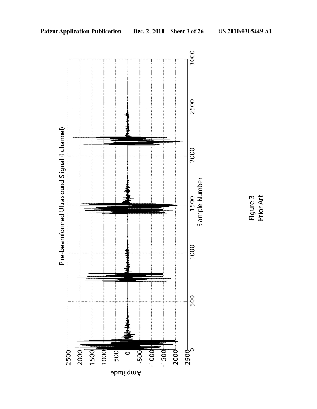 ULTRASOUND SIGNAL COMPRESSION - diagram, schematic, and image 04