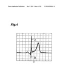 ELECTROCARDIOGRAPH WITH EXTENDED LEAD FUNCTION, AND EXTENDED LEAD ELECTROCARDIOGRAM DERIVING METHOD diagram and image