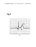 ELECTROCARDIOGRAPH WITH EXTENDED LEAD FUNCTION, AND EXTENDED LEAD ELECTROCARDIOGRAM DERIVING METHOD diagram and image