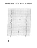 ELECTROCARDIOGRAPH WITH EXTENDED LEAD FUNCTION, AND EXTENDED LEAD ELECTROCARDIOGRAM DERIVING METHOD diagram and image