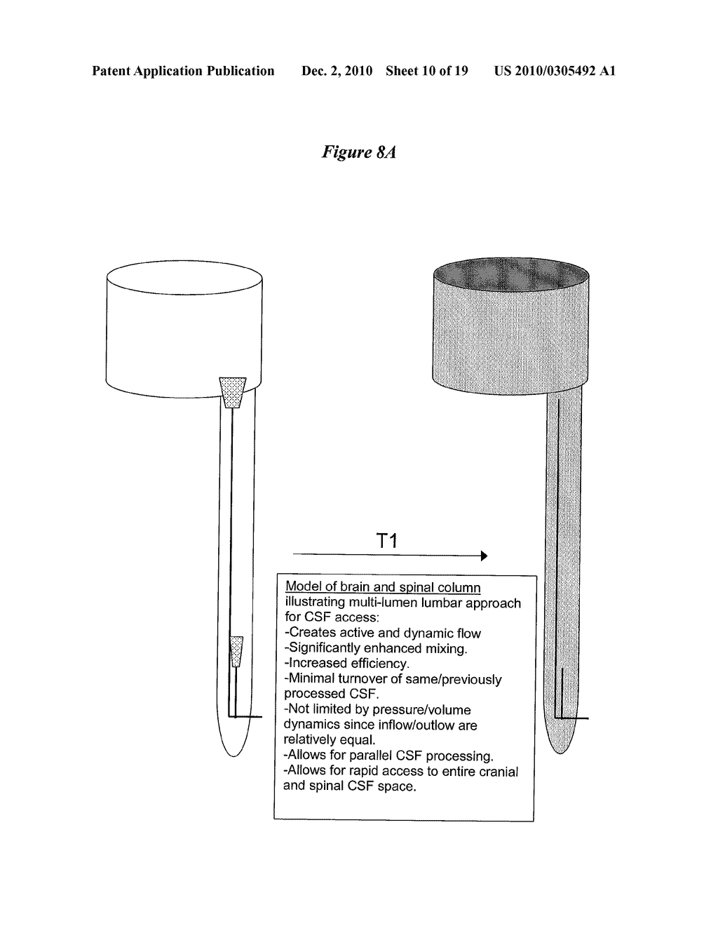 Cerebrospinal Fluid Purification System - diagram, schematic, and image 11