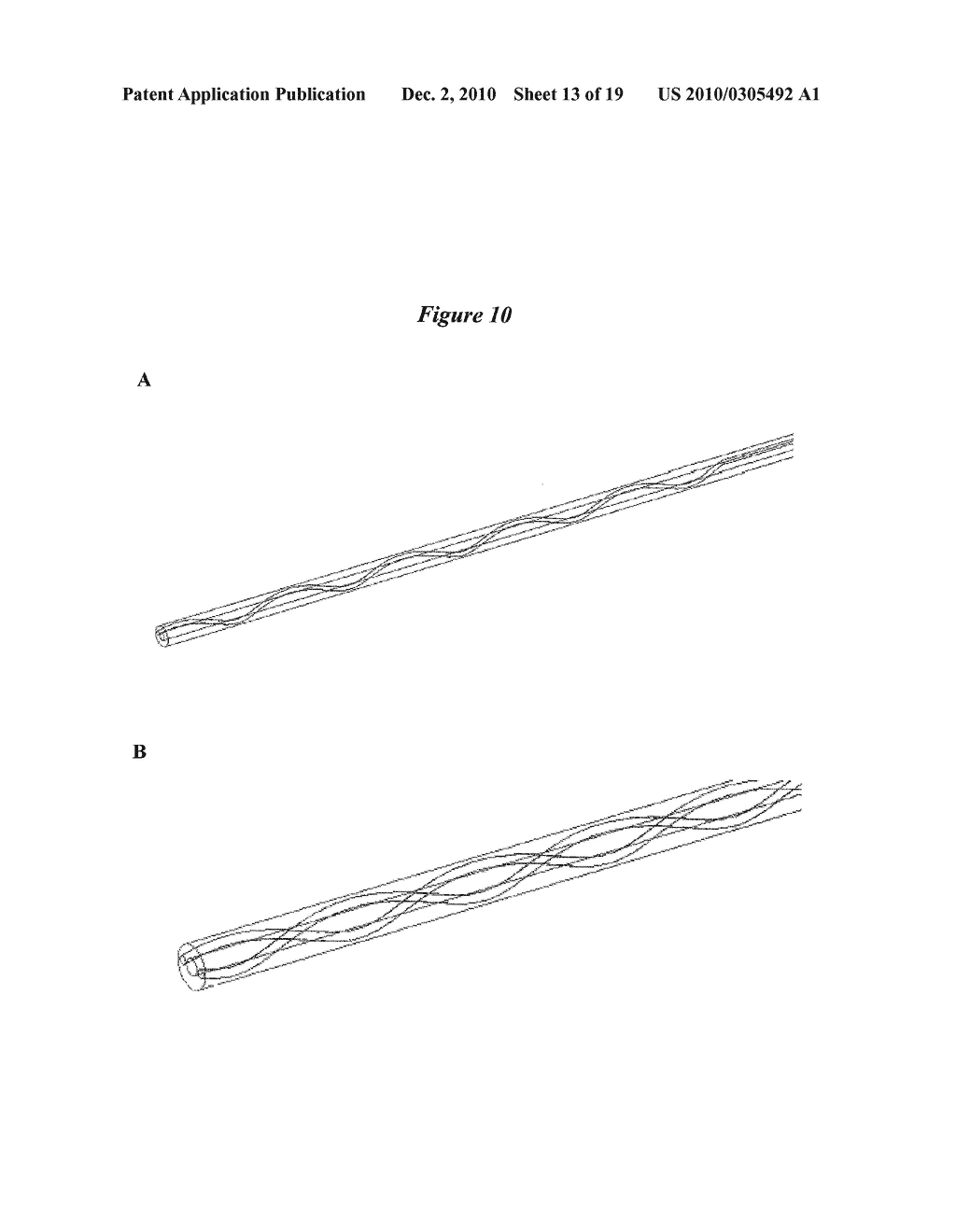 Cerebrospinal Fluid Purification System - diagram, schematic, and image 14