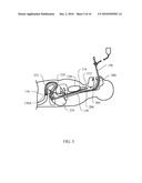 OPTICALLY GUIDED FEEDING TUBE, CATHETERS AND ASSOCIATED METHODS diagram and image