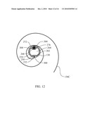 OPTICALLY GUIDED FEEDING TUBE, CATHETERS AND ASSOCIATED METHODS diagram and image