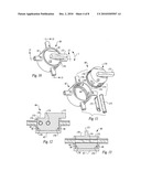 Compact non-electric medicament infuser diagram and image