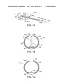 METHODS AND KITS FOR VOLUMETRIC DISTRIBUTION OF PHARMACEUTICAL AGENTS VIA THE VASCULAR ADVENTITIA AND MICROCIRCULATION diagram and image