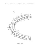 EXTERNAL FIXATOR RING diagram and image