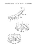 EXTERNAL FIXATOR RING diagram and image