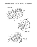 SURGICAL CABLE TENSIONING SYSTEM diagram and image