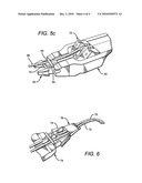 SURGICAL CABLE TENSIONING SYSTEM diagram and image