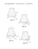 Patient Selectable Joint Arthroplasty Devices and Surgical Tools diagram and image