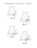 Patient Selectable Joint Arthroplasty Devices and Surgical Tools diagram and image