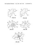 Patient Selectable Joint Arthroplasty Devices and Surgical Tools diagram and image