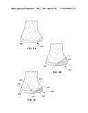 Patient Selectable Joint Arthroplasty Devices and Surgical Tools diagram and image