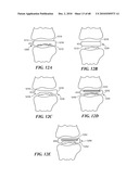 Patient Selectable Joint Arthroplasty Devices and Surgical Tools diagram and image