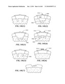 Patient Selectable Joint Arthroplasty Devices and Surgical Tools diagram and image