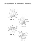 Patient Selectable Joint Arthroplasty Devices and Surgical Tools diagram and image