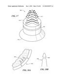 Patient Selectable Joint Arthroplasty Devices and Surgical Tools diagram and image