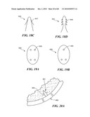 Patient Selectable Joint Arthroplasty Devices and Surgical Tools diagram and image