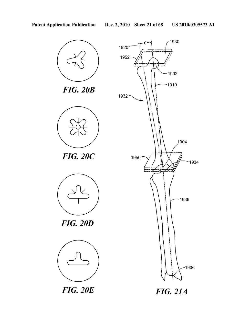 Patient Selectable Joint Arthroplasty Devices and Surgical Tools - diagram, schematic, and image 22