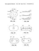 Patient Selectable Joint Arthroplasty Devices and Surgical Tools diagram and image