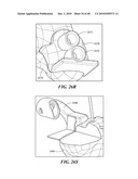 Patient Selectable Joint Arthroplasty Devices and Surgical Tools diagram and image