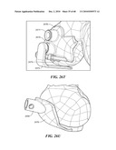 Patient Selectable Joint Arthroplasty Devices and Surgical Tools diagram and image