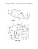 Patient Selectable Joint Arthroplasty Devices and Surgical Tools diagram and image