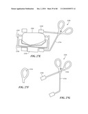 Patient Selectable Joint Arthroplasty Devices and Surgical Tools diagram and image