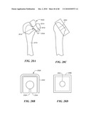 Patient Selectable Joint Arthroplasty Devices and Surgical Tools diagram and image