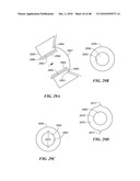 Patient Selectable Joint Arthroplasty Devices and Surgical Tools diagram and image