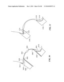 Patient Selectable Joint Arthroplasty Devices and Surgical Tools diagram and image