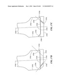 Patient Selectable Joint Arthroplasty Devices and Surgical Tools diagram and image