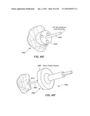 Patient Selectable Joint Arthroplasty Devices and Surgical Tools diagram and image