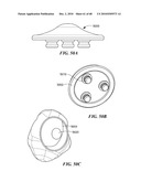 Patient Selectable Joint Arthroplasty Devices and Surgical Tools diagram and image