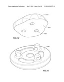 Patient Selectable Joint Arthroplasty Devices and Surgical Tools diagram and image