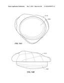 Patient Selectable Joint Arthroplasty Devices and Surgical Tools diagram and image