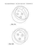 Patient Selectable Joint Arthroplasty Devices and Surgical Tools diagram and image