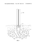 SUTURE ANCHORING INSTRUMENT diagram and image