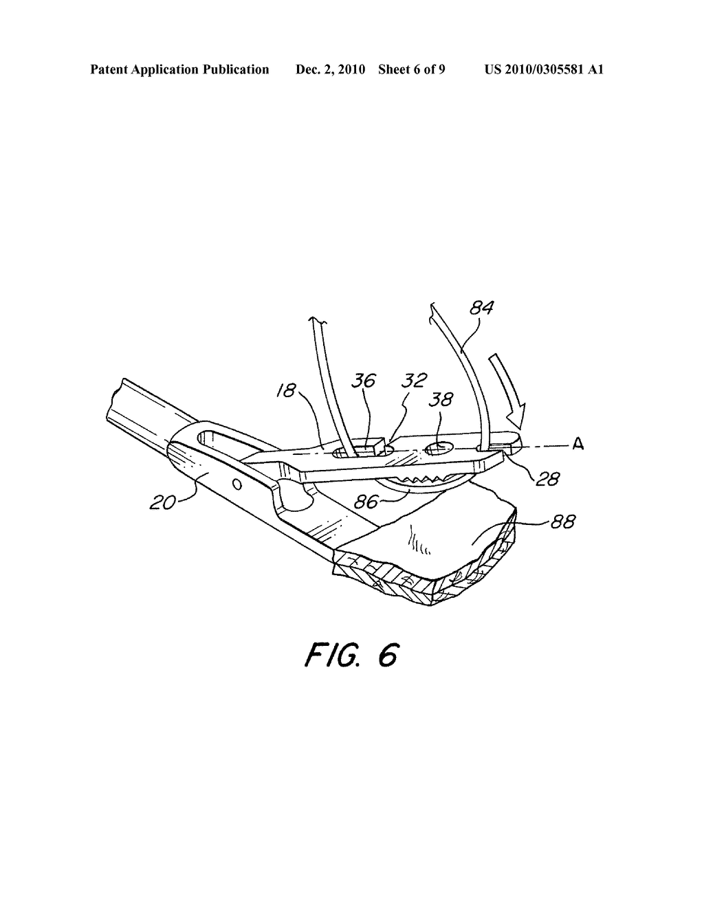 Suture Passing Instrument - diagram, schematic, and image 07