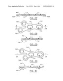 Orthopedic plate diagram and image