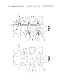 SURGICAL INSTRUMENT FOR FIXING A CLAMP TO A BONE FIXATION DEVICE diagram and image