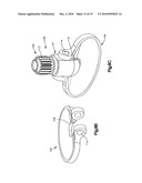 SURGICAL INSTRUMENT FOR FIXING A CLAMP TO A BONE FIXATION DEVICE diagram and image