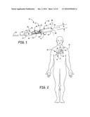 ELONGATE BATTERY FOR IMPLANTABLE MEDICAL DEVICE diagram and image