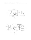 TACHYARRHYTHMIA DETECTION AND DISCRIMINATION BASED ON CURVATURE PARAMETERS diagram and image