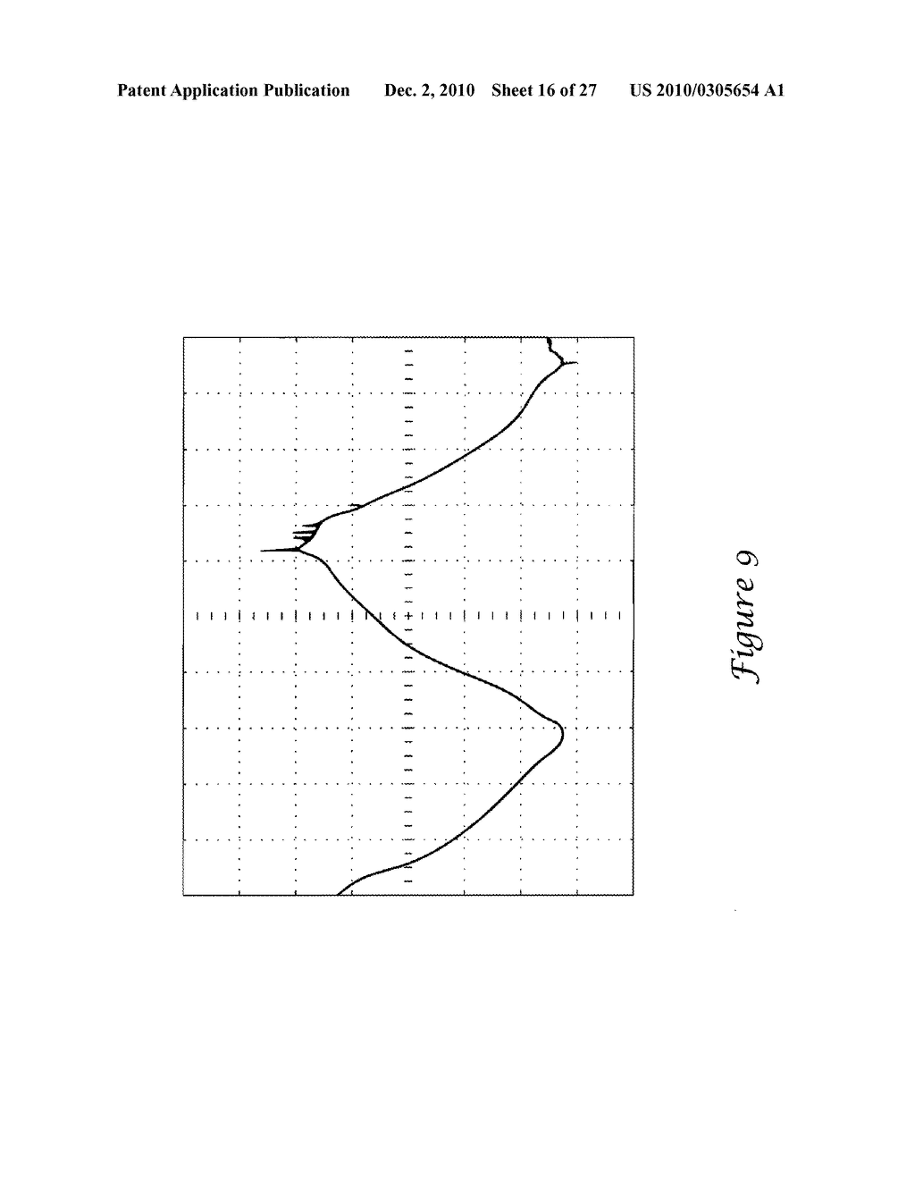 Electromagnetic Interference Shielding in an Implantable Medical Device - diagram, schematic, and image 17