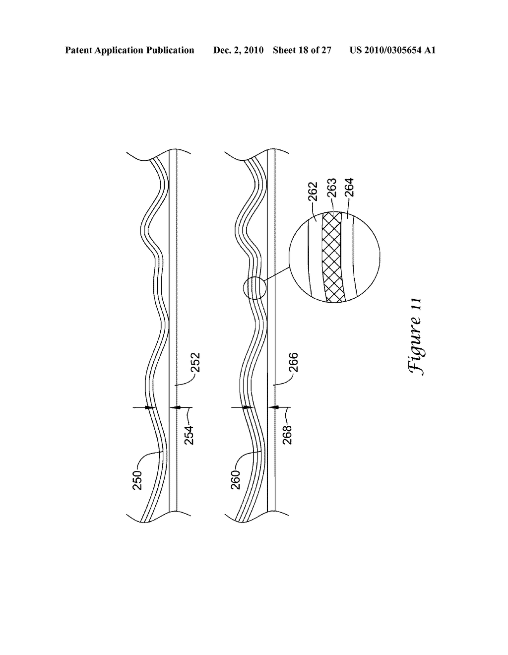 Electromagnetic Interference Shielding in an Implantable Medical Device - diagram, schematic, and image 19